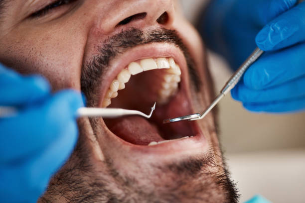 Best Urgent Dental Care for Toothache in Neuse Forest, NC